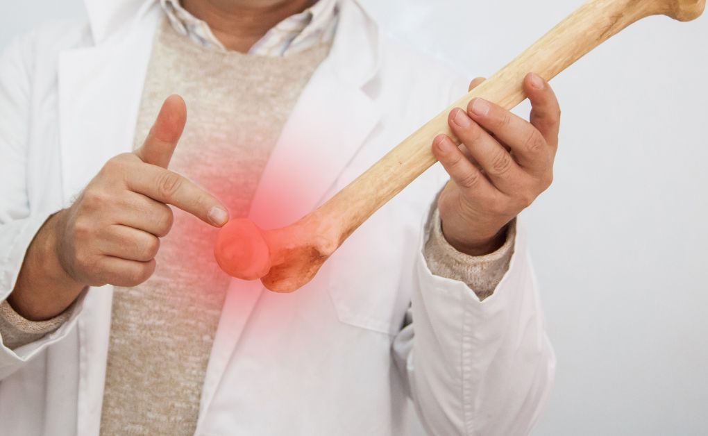 অস্টিওপোরোসিস ও রিউমাটয়েড আর্থ্রাইটিস বা গেঁটেবাত এর কারল, লক্ষণ, প্রতিকার।