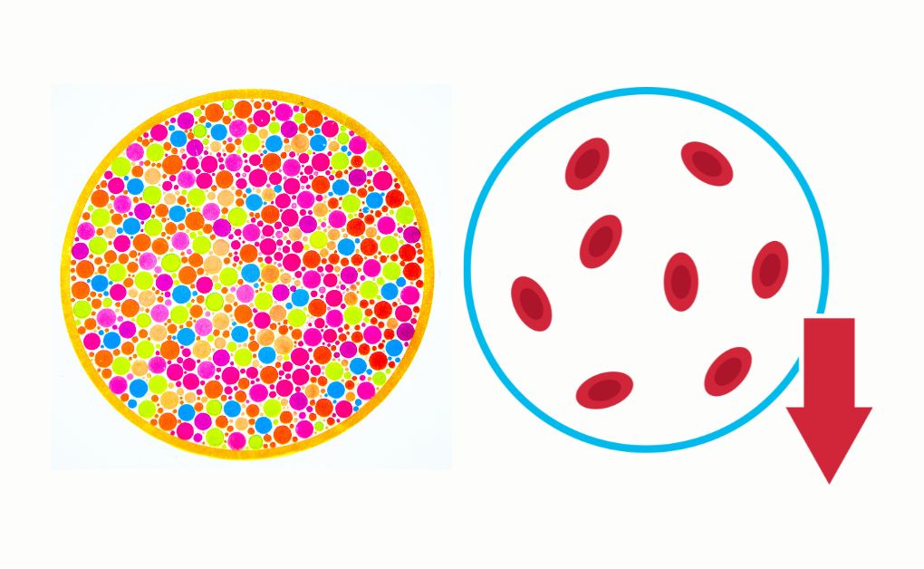 জেনেটিক ডিসঅর্ডার বা বংশগতি ব্যাধি, কি কেন কিভাবে কালার ব্লাইন্ডনেস, থ্যালাসেমিয়া।