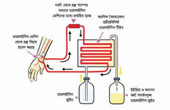 বৃক্ককিডনি বিকল, কিডনি ডায়ালাইসিস ও কিডনি প্রতিস্থাপন, মূত্রনালি সুস্থ রাখার উপায়।