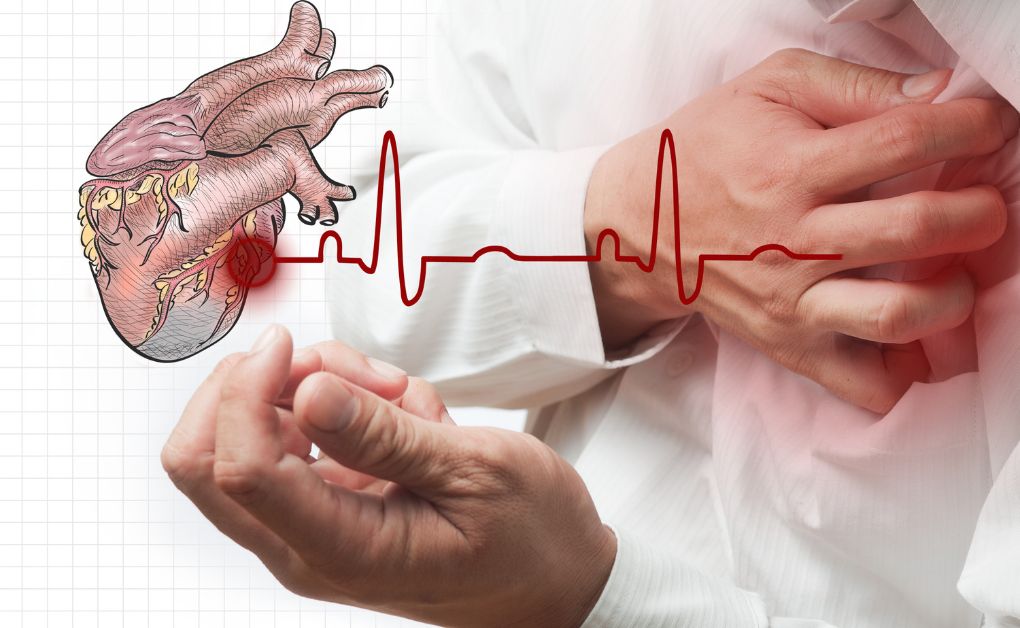 হার্ট অ্যাটাক, কি, কখন, কিভাবে, কেন হয়, এর লক্ষণসমূহ ও হার্ট সুস্থ রাখার উপায়। বাতজ্বর।