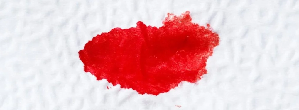 ইস্তেহাযা বা রোগ জনিত রক্তস্রাব