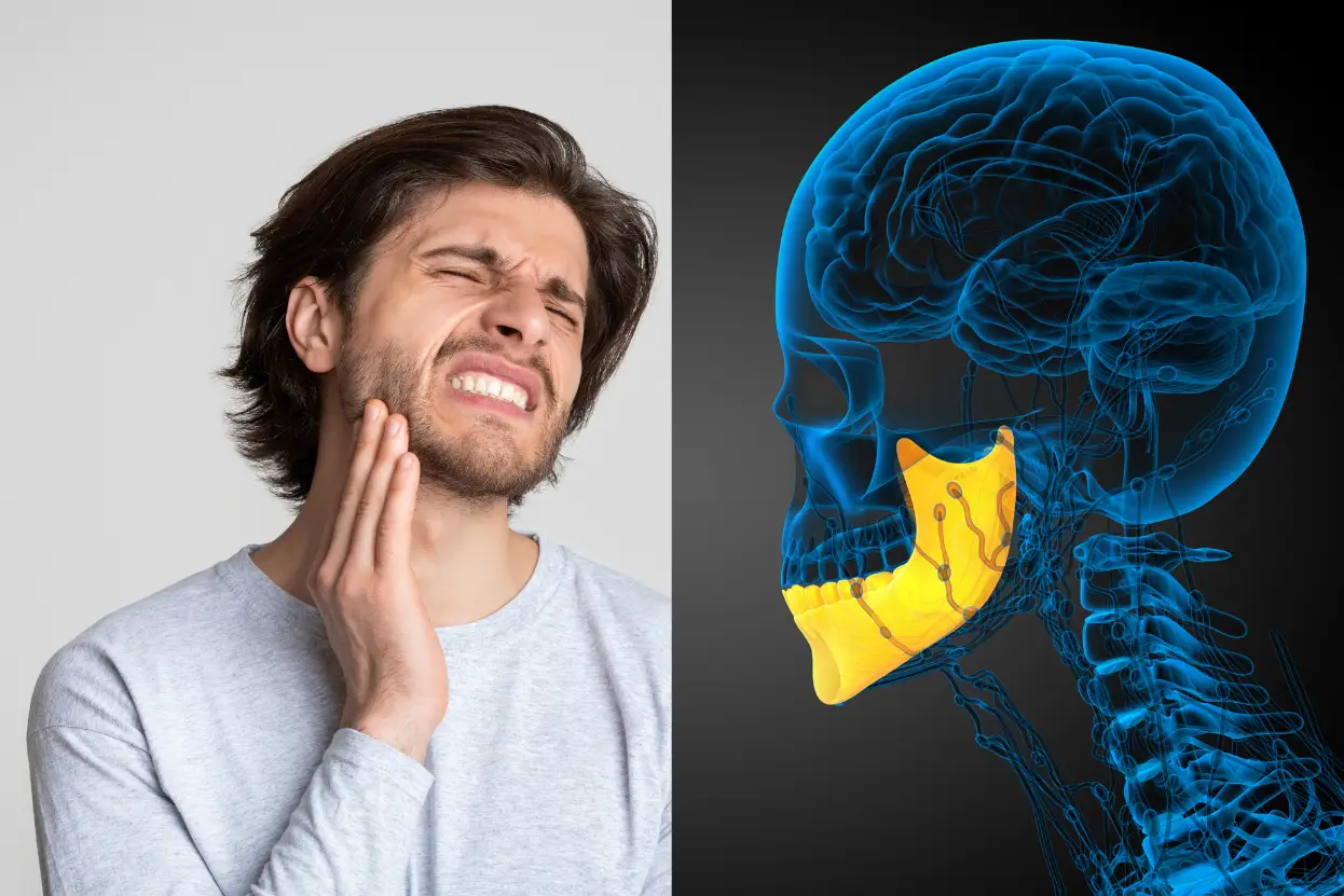 চোয়ালের জয়েন্টে সমস্যা (টিএমডি) এর কারণ, লক্ষণ ও চিকিৎসা