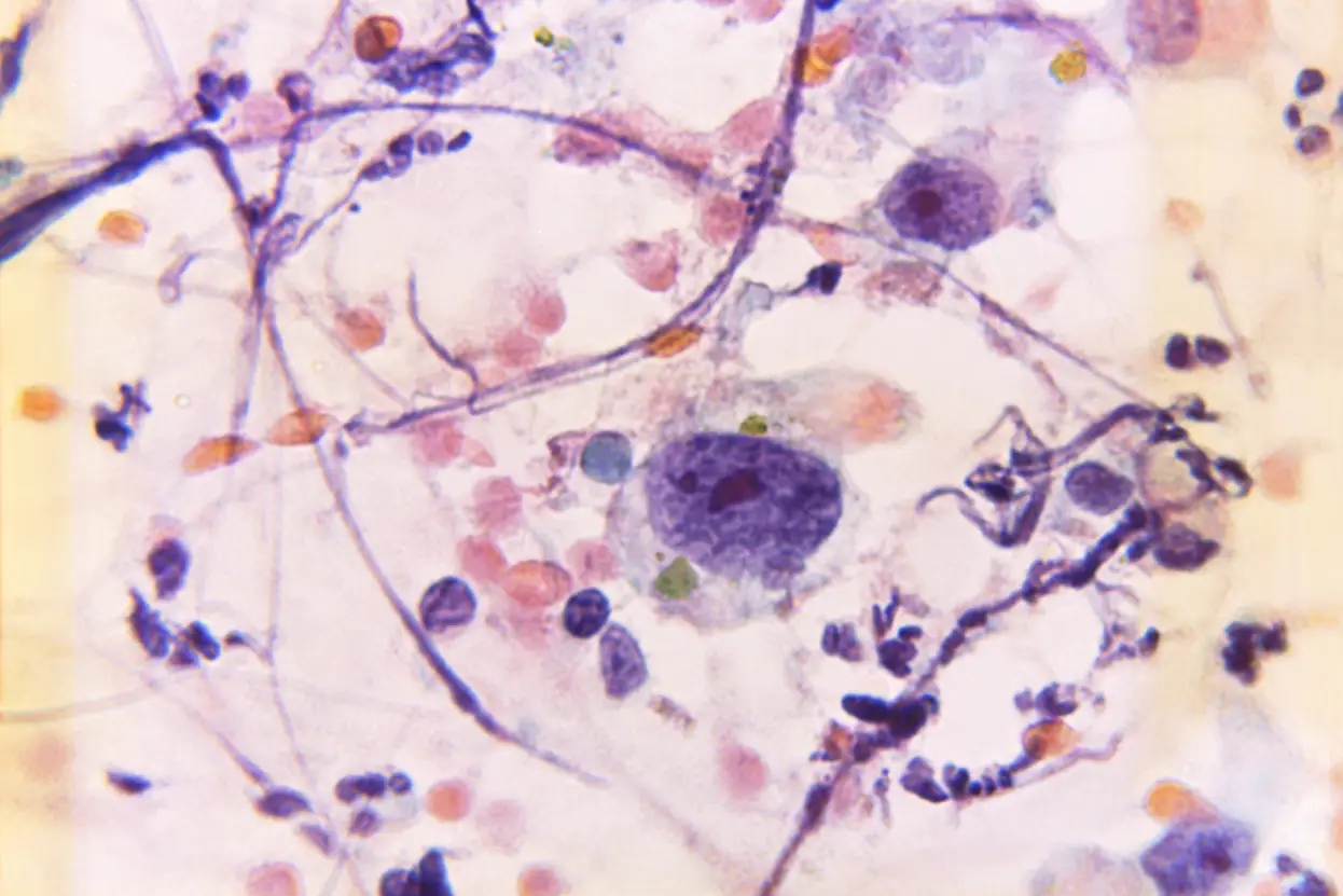 নার্ভের রোগের লক্ষণ ও প্রতিকার