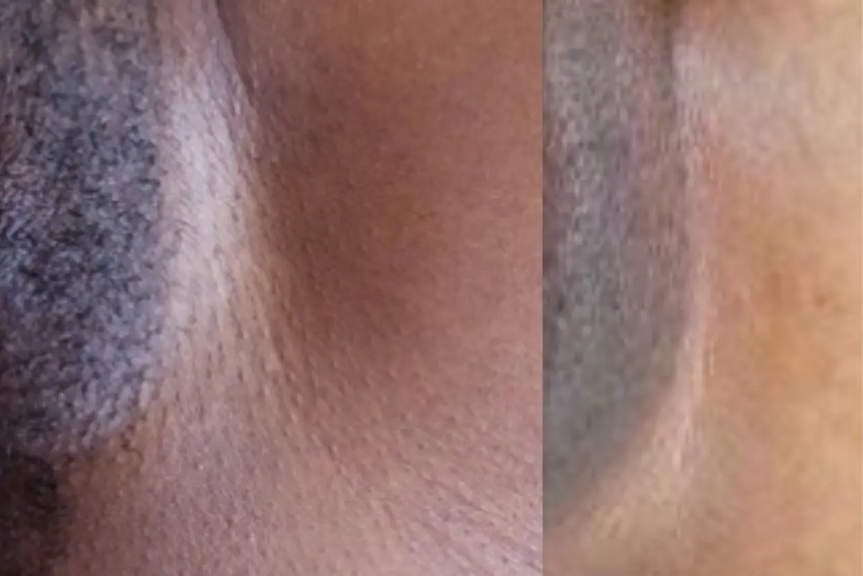 মেয়েদের যোনিপথ কালো হয় কেন, কারণ, সমাধান ও ঘরোয়া উপায়