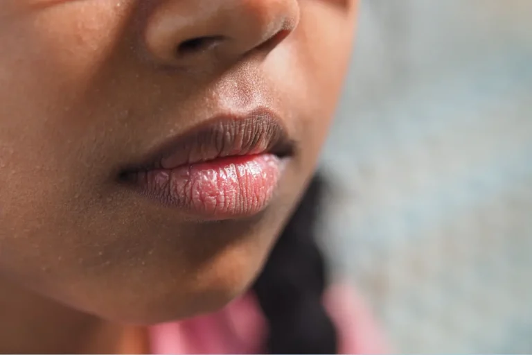 শীতে ঠোঁটের যত্ন নেওয়ার ৭টি কার্যকরী টিপস